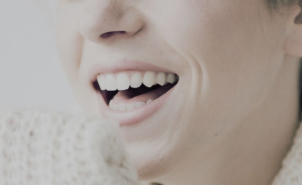 Manchas en los dientes diseño de sonrisa