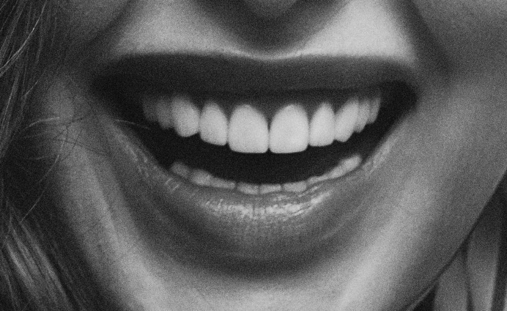 Tipos de sonrisa y la estetica dental